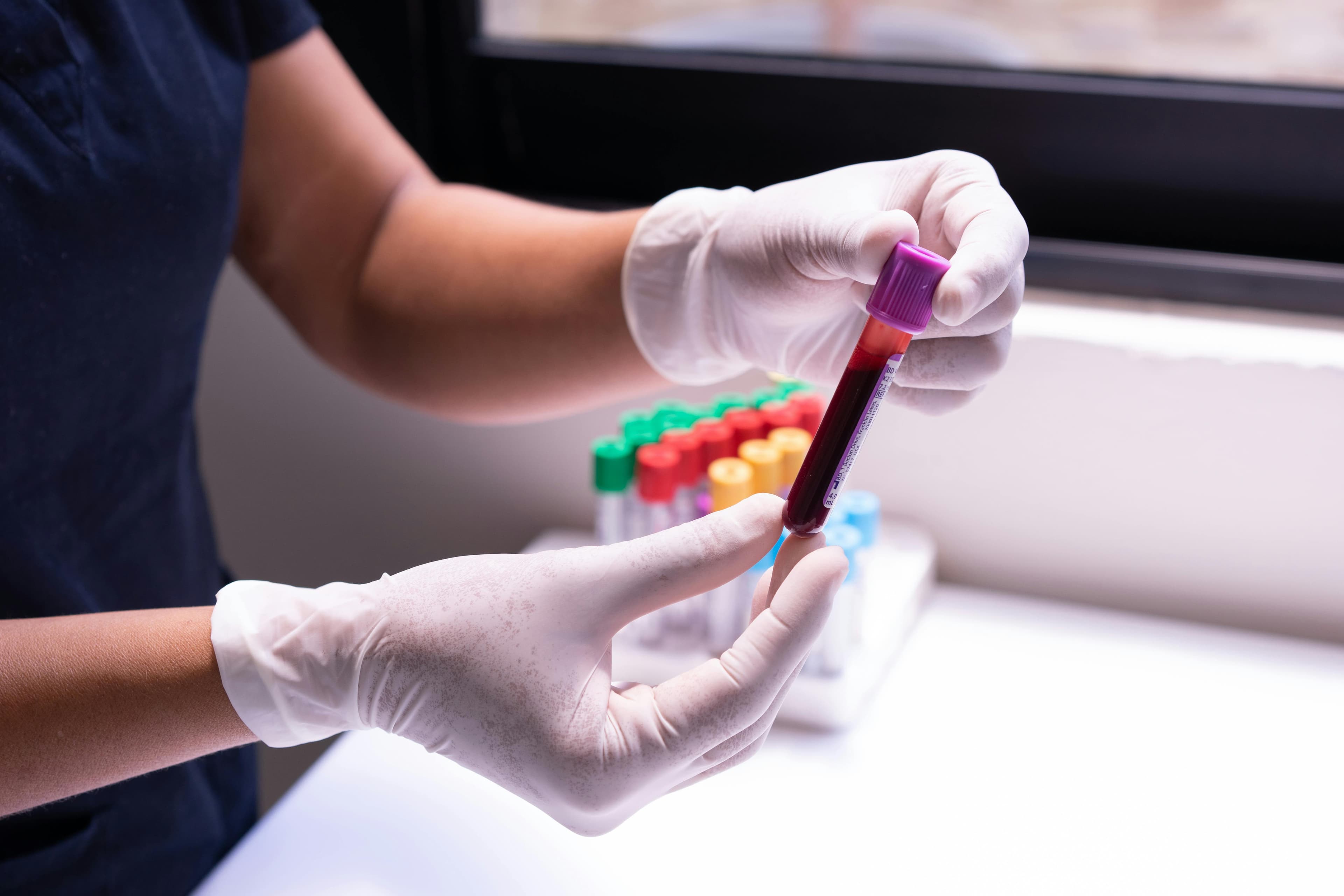 Fertility blood tests for men and women